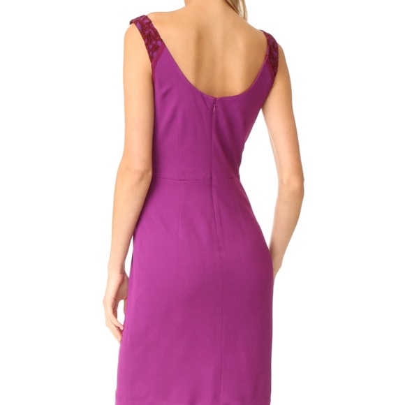 DVF Diane von Furstenberg Geovana Lace Dress - Picture 3 of 7